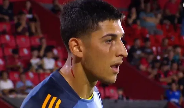 El corte que sufrió Brey en el calentamiento ante Newell's. (Captura)
