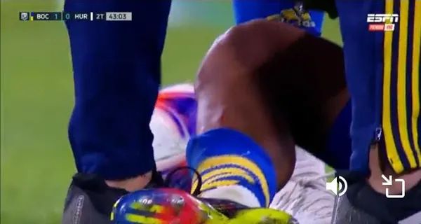 La pierna de Medina tras la patada de Godoy. (Captura de pantalla de Espn).