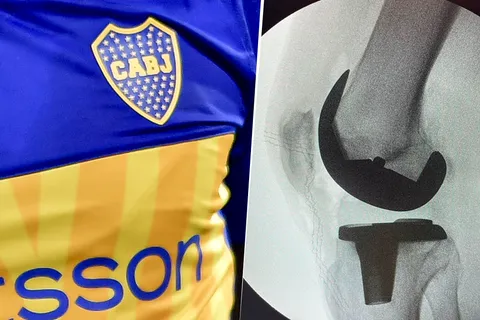 El ídolo de Boca que se operó la rodilla a los 64 años: "A recuperarse"