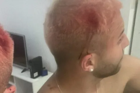 VIDEO | Incidentes en Río de Janeiro: varios hinchas de Boca fueron agredidos por gente de Fluminense