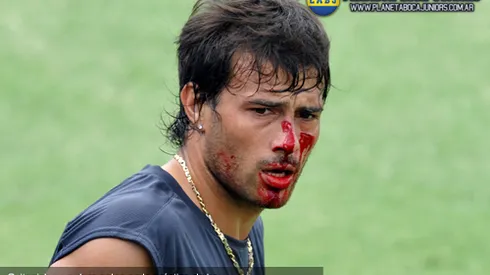 Cvitanich habló sobre su accidente