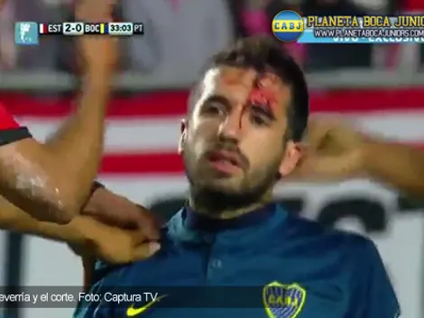 Un debut accidentado
