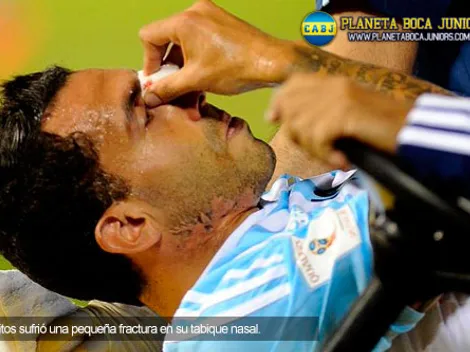 Parte médico de Tevez