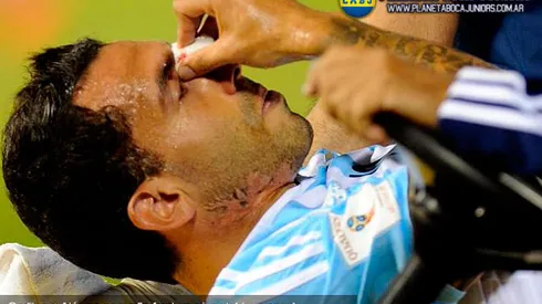 Parte médico de Tevez