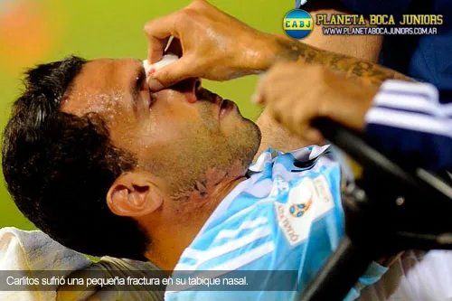 tevez