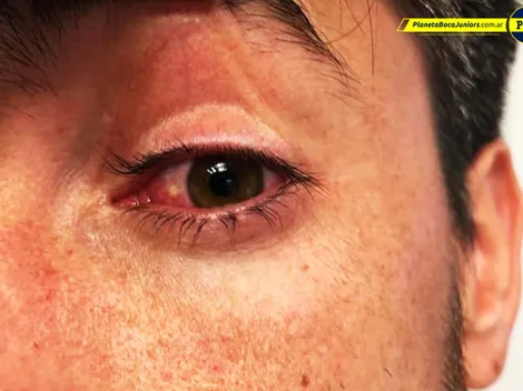 Insólito parte médico de CONMEBOL