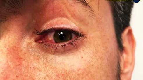 Insólito parte médico de CONMEBOL