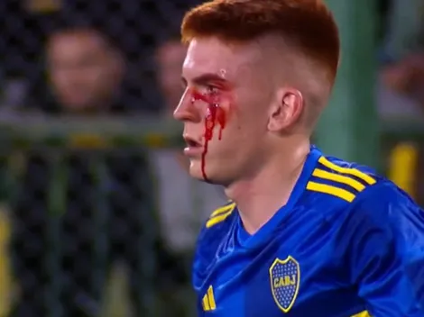 VIDEO | Cómo quedó el Colo Barco tras el duro golpe que recibió contra Defensa y Justicia