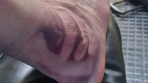 La impresionante recuperación de una figura del Básquet de Boca.