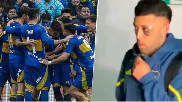 Boca hoy: qué le pasó a Janson en el ojo y los dos jugadores que los hinchas piden para el Superclásico ante River