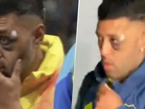 Revelado: por qué Janson apareció con el ojo lastimado en el partido entre Boca y Racing