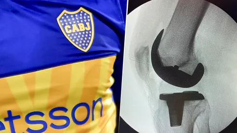 Es ídolo del Xeneize y pasó por el bisturí.