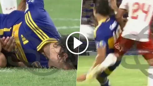 Así fue la lesión de Cavani en la espalda
