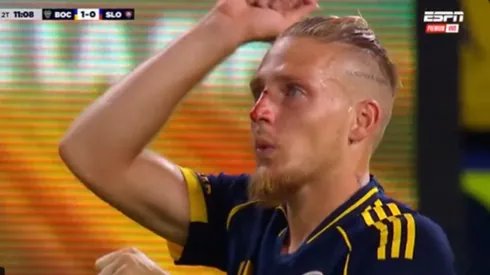 Se supo por qué Ascacibar tenía sangre en su rostro. 
